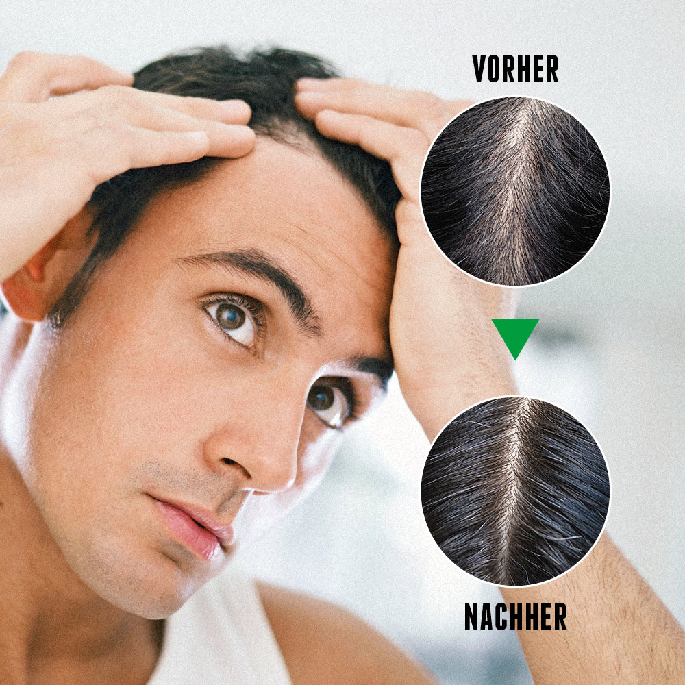Das Activator Hair Bundle sorgt für sichtbare Ergebnisse und deutlich dichteres Haar im vorher-nachher-Vergleich.