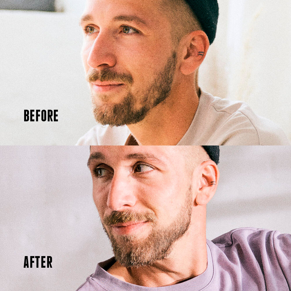 Before and after comparison of a man’s beard growth, showing fuller, thicker facial hair after using the beard roller.[INT] [EU]