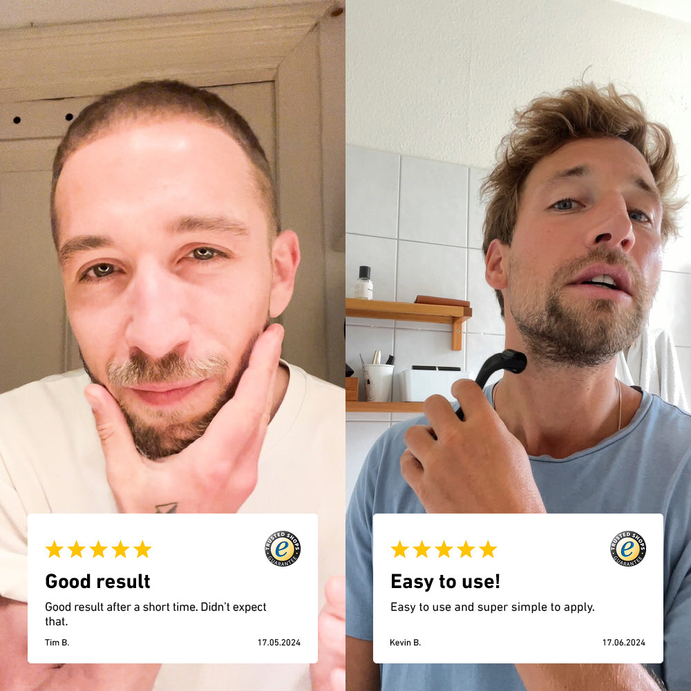 Two customer photos showing results with the beard roller happy with the results, writting excellent reviews. [INT] [EU]